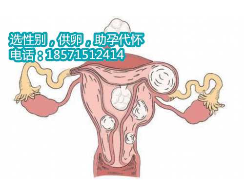 重庆代生最便宜,女性子宫内膜异位症会出现什么症状